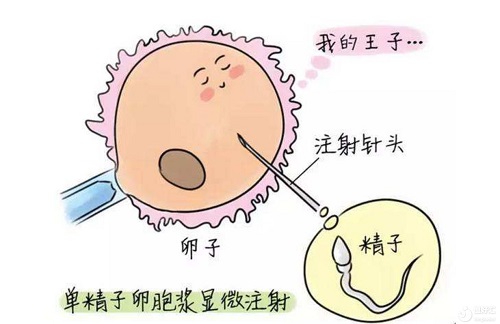 2022年做第三代試管嬰兒要準(zhǔn)備多少錢