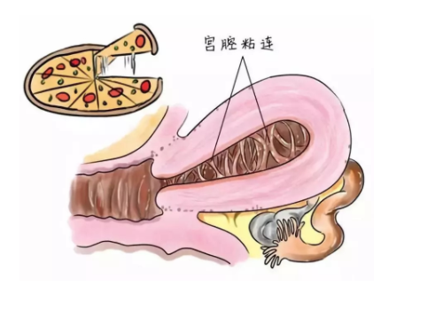 泰國(guó)試管費(fèi)用很貴嗎？?
