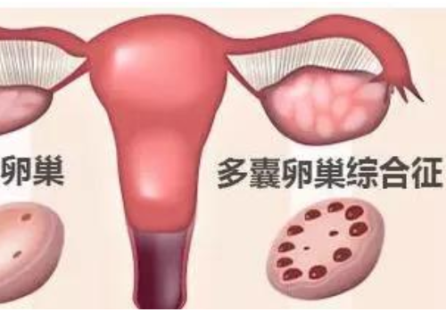 做美國試管一次的價格？