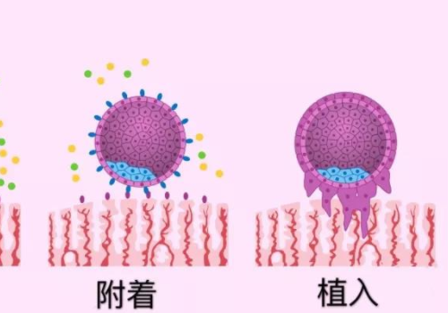 北京去俄羅斯做試管助孕的好處？